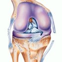 Orthopedics