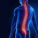 Spinal Surgery